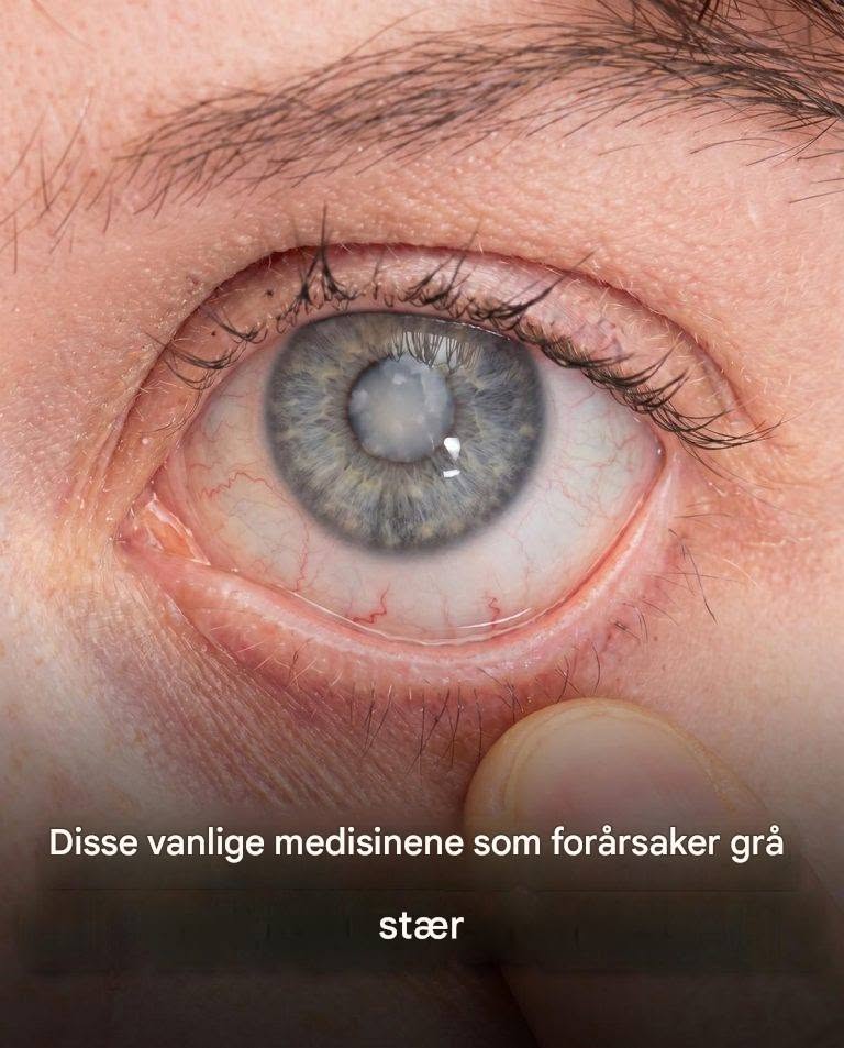 Glem myten om alder: her er de virkelige, lite kjente synderne som truer synet ditt hver dag.